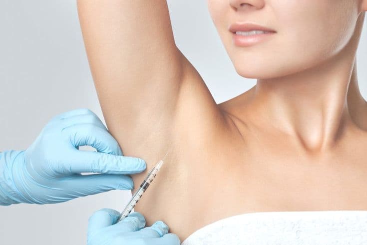 underarm botox